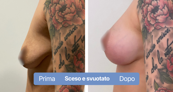 8-1- asimmetrico (2)