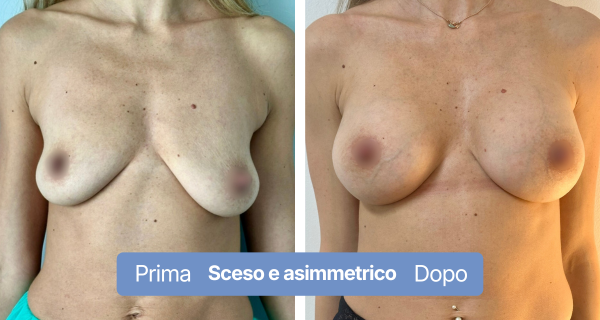 8-1- asimmetrico (4)